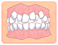 歯並びが悪い方